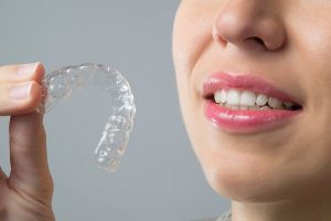 Invisalign stock photo