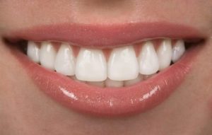 Perfect healthy teeth smile of a young woman stock photo