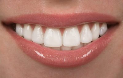 Perfect healthy teeth smile of a young woman stock photo