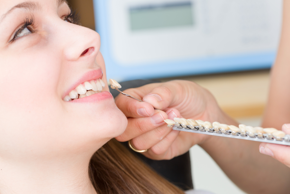 Using shade guide to check veneer of tooth crown stock photo